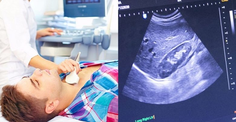 سونوگرافی غددلنفاوی g/سونوگرافی غددلنفاوی