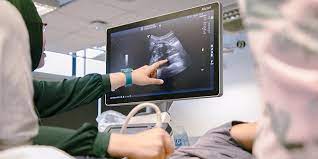 Ultrasound screening first سونوگرافی غربالگری اول| Ultrasound screening first