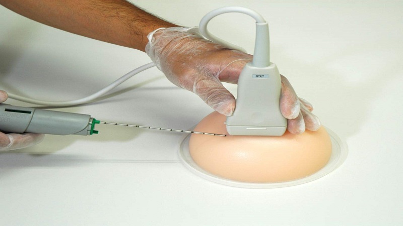 بیوپسی از پستان m/بیوپسی از پستان