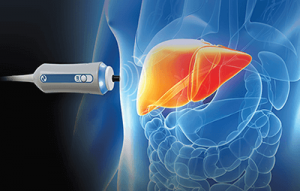 هزینه فیبرواسکن کبد n/هزینه فیبرواسکن کبد