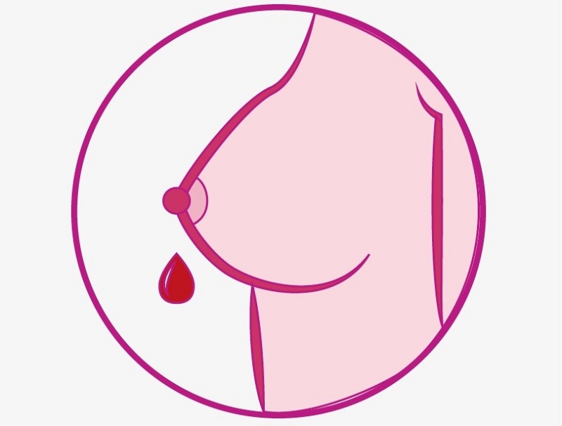 ترشح پستان k/ترشح پستان