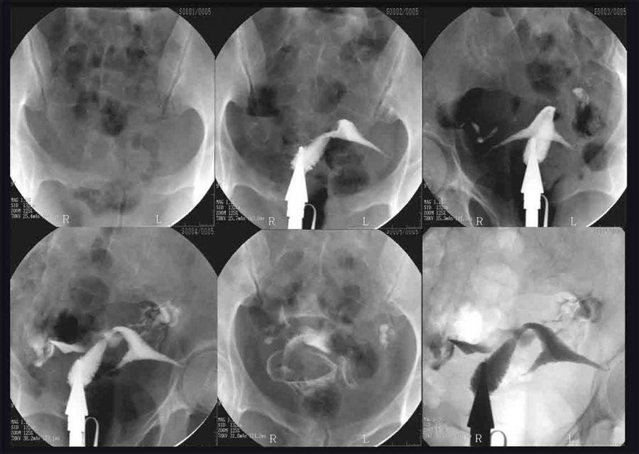 عکس رنگی رحم چیست؟ s/عکس رنگی رحم چیست؟