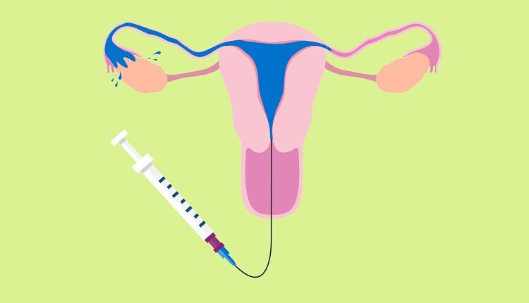 عکس رنگی رحم s/عکس رنگی رحم