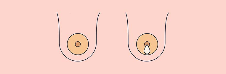 ترشح پستان f/ترشح پستان