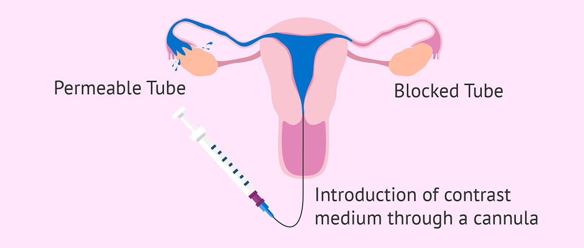 عکس رنگی رحم d/عکس رنگی رحم