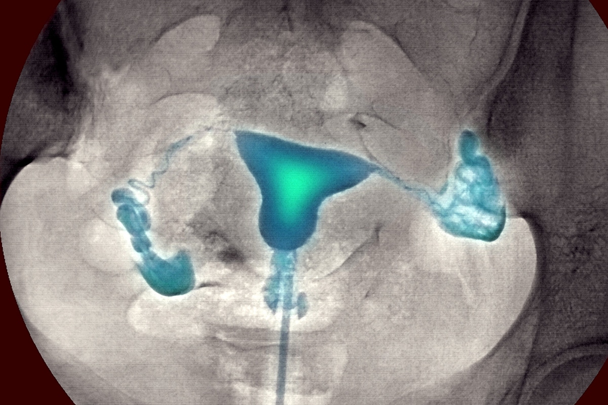 عکس رنگی رحم y/عکس رنگی رحم