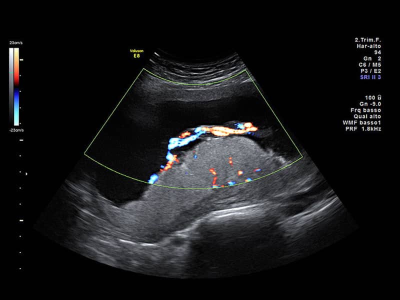 آمادگی های سونو گرافی آنومالی مرحله دوم a/آمادگی های سونو گرافی آنومالی مرحله دوم