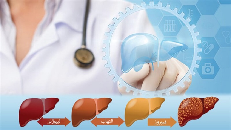 آمادگی سونو گرافی فیبرو اسکن کبد s/آمادگی سونو گرافی فیبرو اسکن کبد