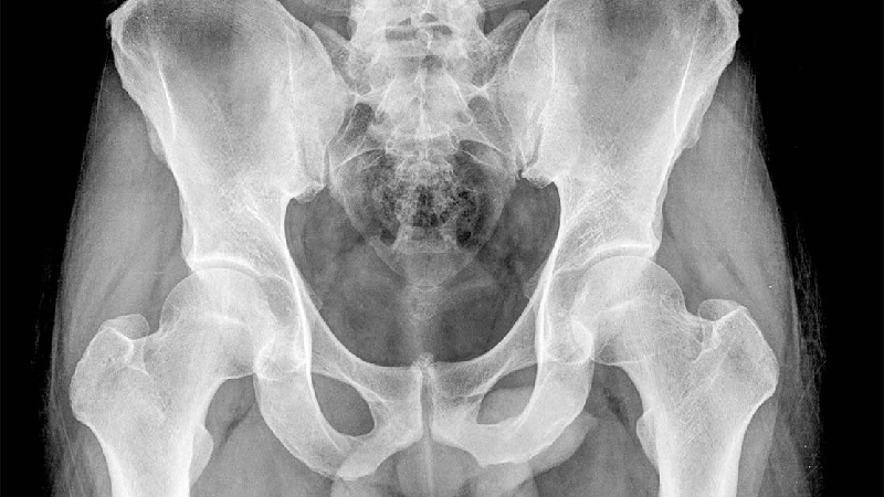 آمادگی رادیو گرافی ساده شکم w/آمادگی رادیو گرافی ساده شکم