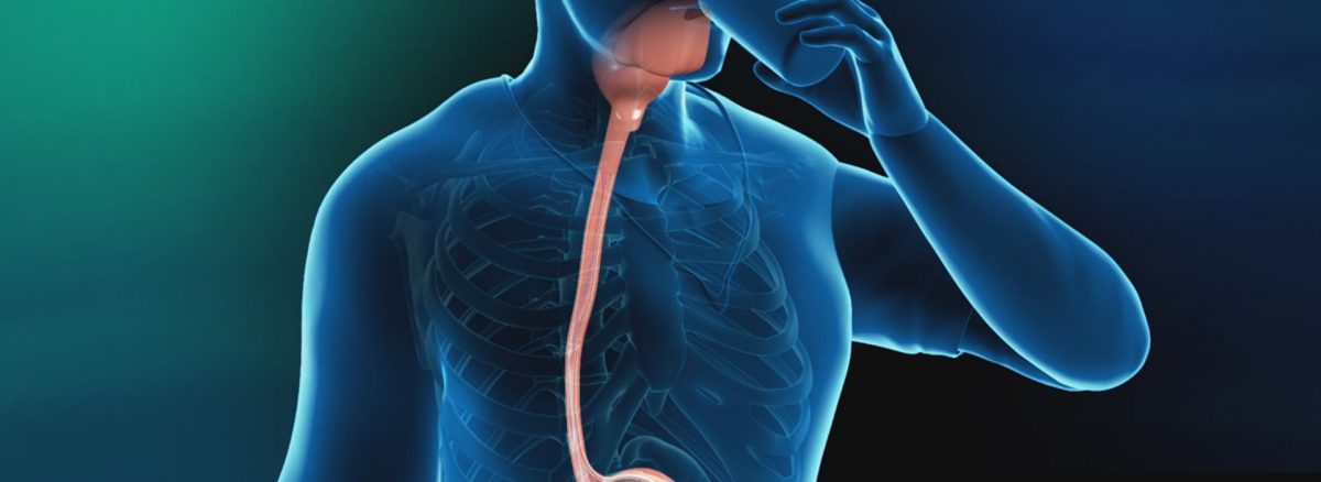 آمادگی رادیو گرافی عکس رنگی از مری ، معده و اثنی عشر r/آمادگی رادیو گرافی عکس رنگی از مری ، معده و اثنی عشر