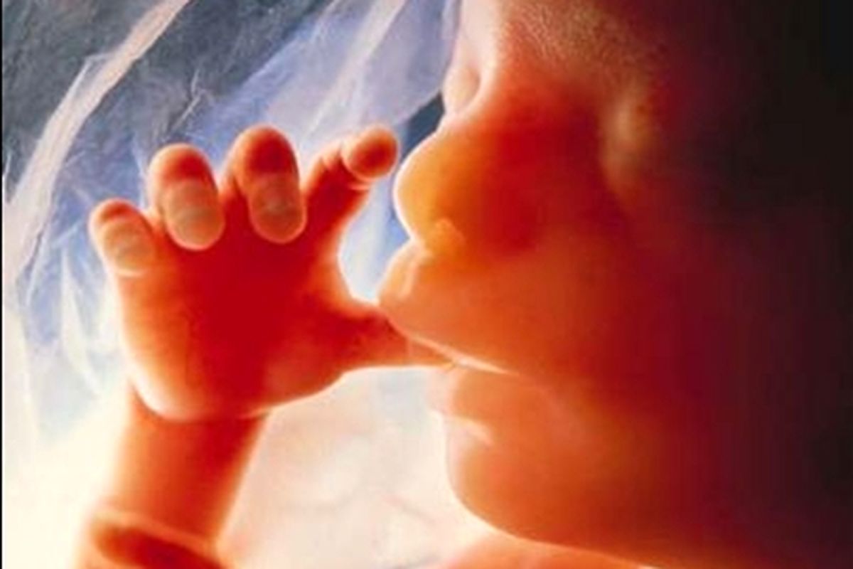 سونوگرافی حاملگی s/سونوگرافی حاملگی