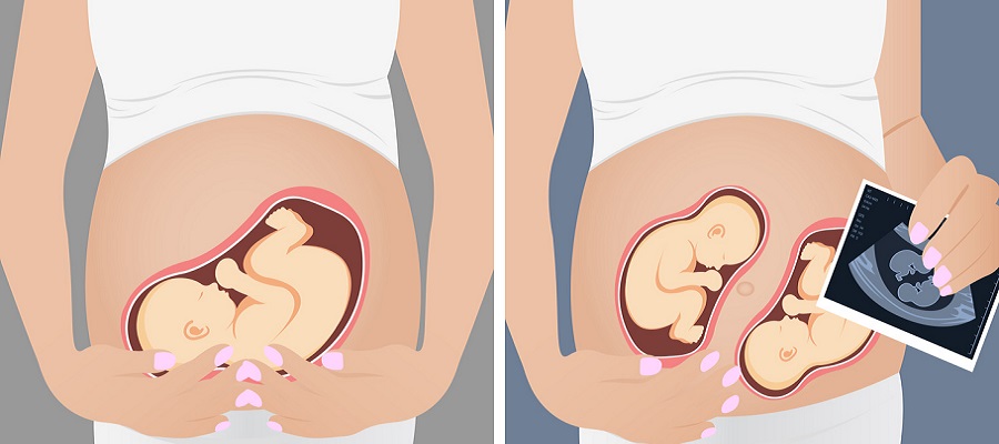 سونوگرافی غربالگری سه ماهه اول بارداری f/سونوگرافی غربالگری سه ماهه اول بارداری