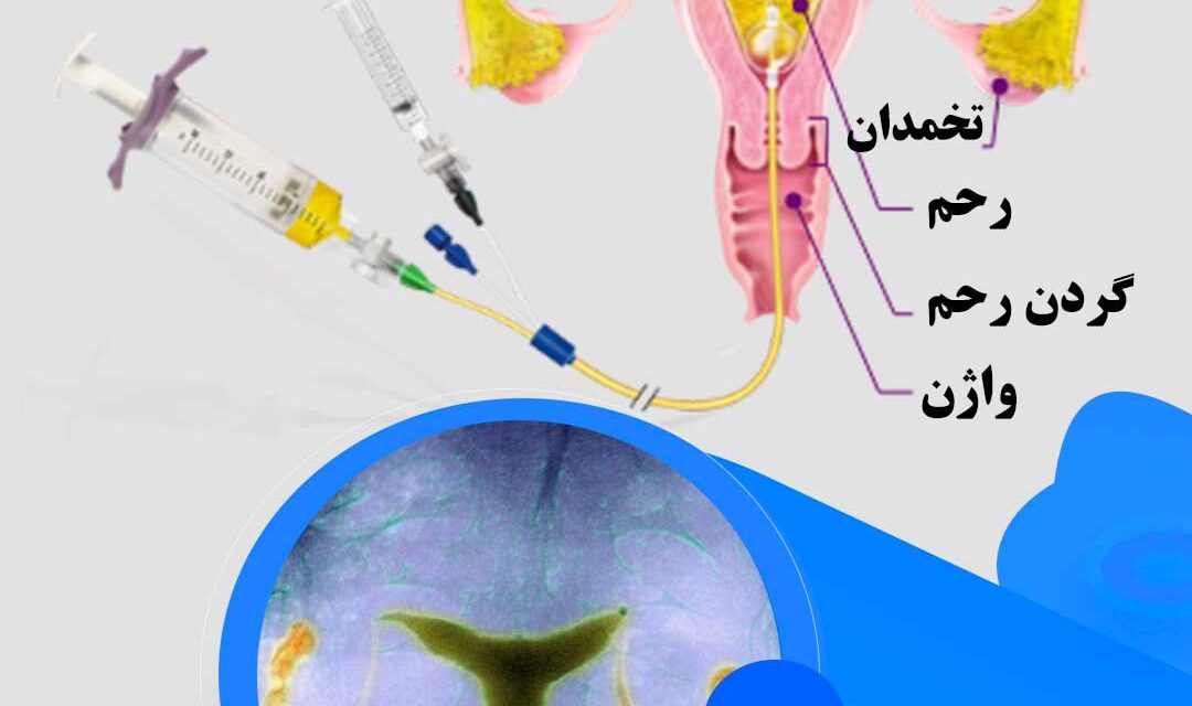 عکس رنگی رحم a/عکس رنگی رحم