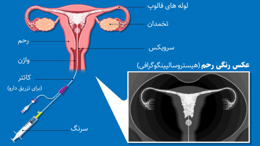 عکس رنگی رحم t/عکس رنگی رحم