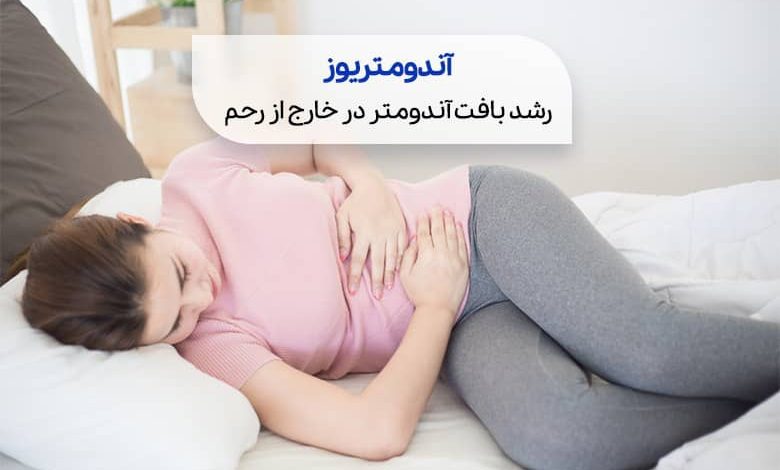علائم اندومتریوز a/علائم اندومتریوز