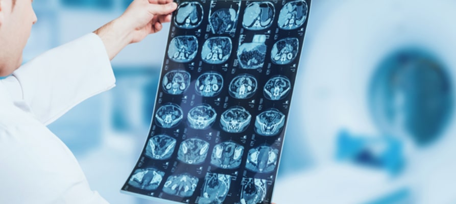 g/مباحث ایمنی رادیولوژی