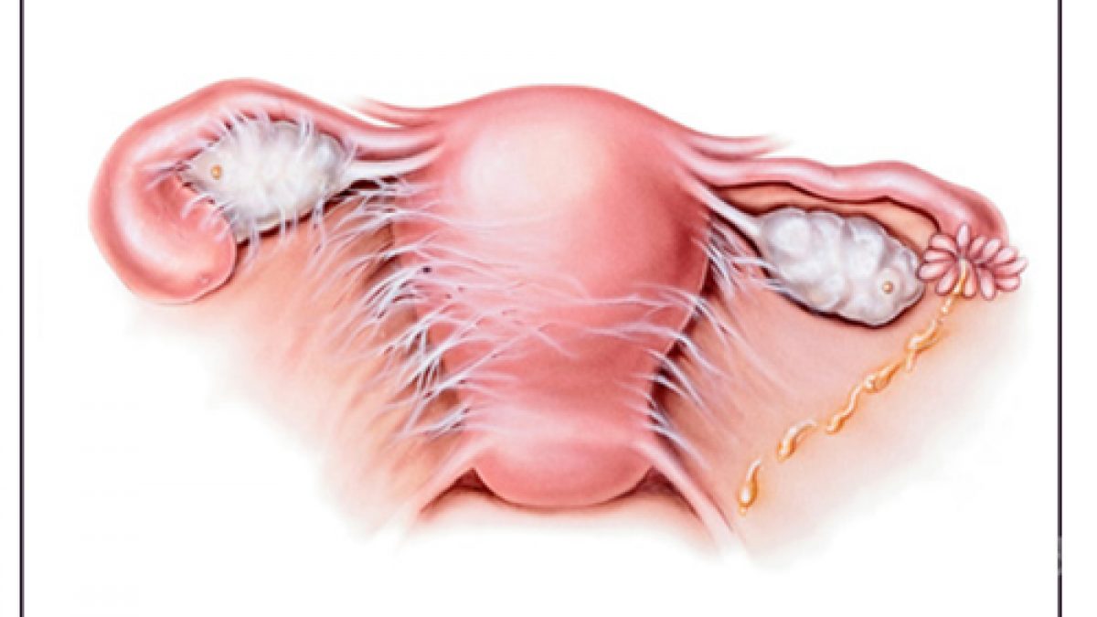 سونوگرافی سه بعدی رحم f/سونوگرافی سه بعدی رحم