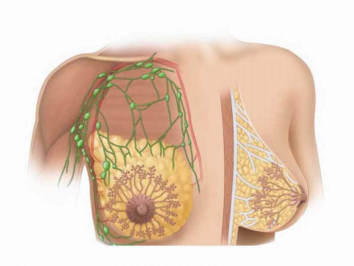 عفونت پستان یا ماستیت چیست؟ d/عفونت پستان یا ماستیت چیست؟