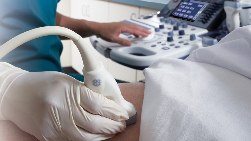 انواع سونوگرافی d/انواع سونوگرافی