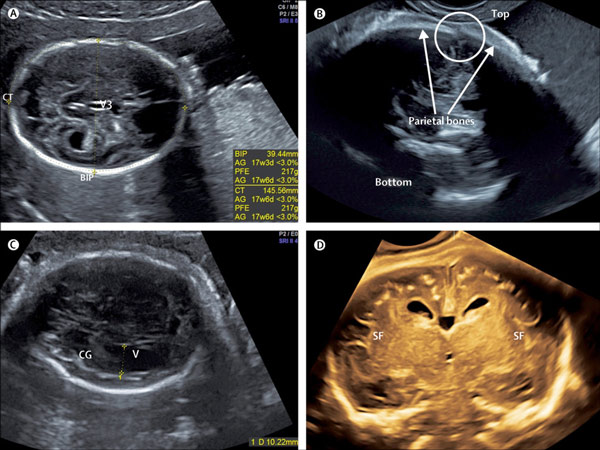 سونوگرافی آنومالی در تهران u/سونوگرافی آنومالی در تهران