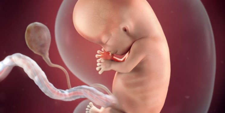 d/سونوگرافی غربالگری جنین