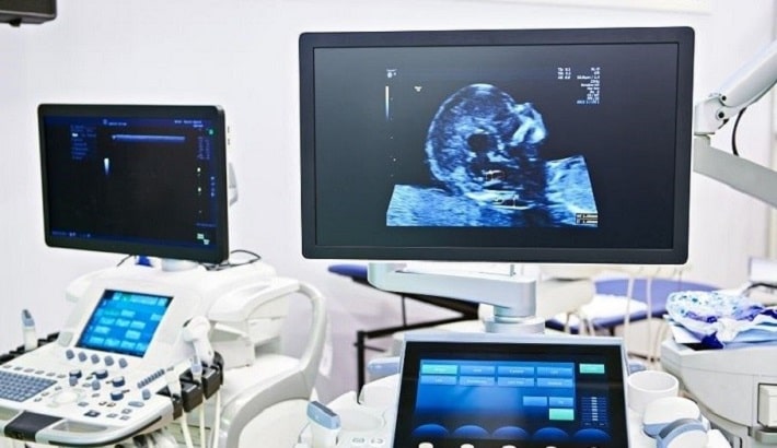 رادیو لوژی و سونوگرافی در تهران d/رادیو لوژی و سونوگرافی در تهران