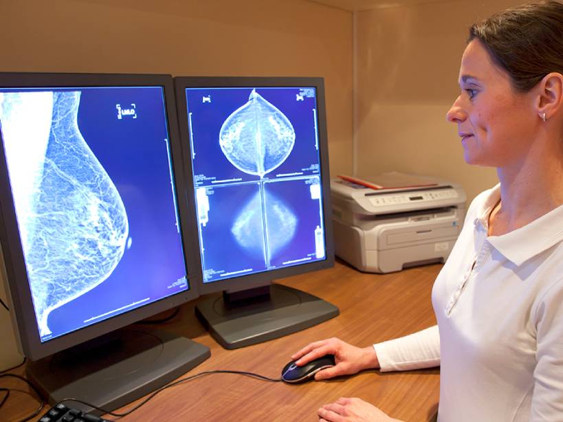 ماموگرافی چیست و چطور انجام می شود؟ s/ماموگرافی چیست و چطور انجام می شود؟