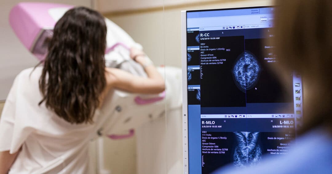 ماموگرافی چیست و چطور انجام می شود؟ s/ماموگرافی چیست و چطور انجام می شود؟