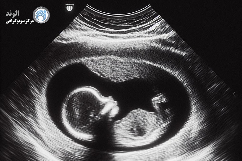 اکوکاردیوگرافی جنین s/اکوکاردیوگرافی جنین