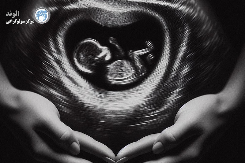 اکوکاردیوگرافی جنین d/اکوکاردیوگرافی جنین