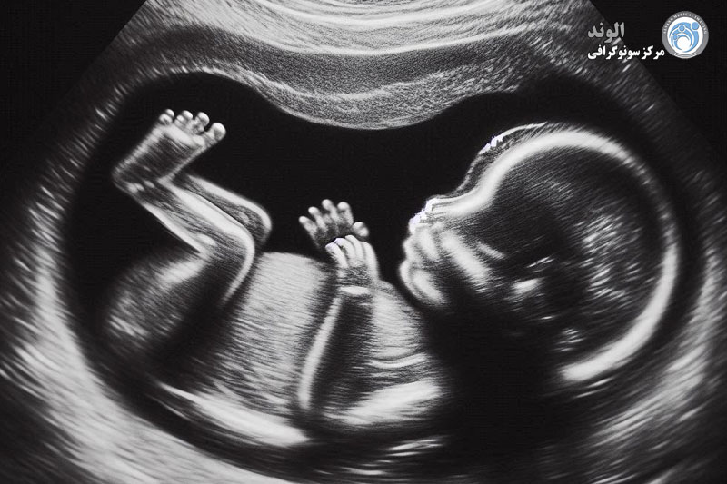 سونوگرافی شبانه روزی j/سونوگرافی شبانه روزی