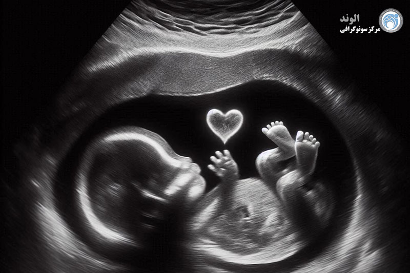 سونوگرافی بارداری
