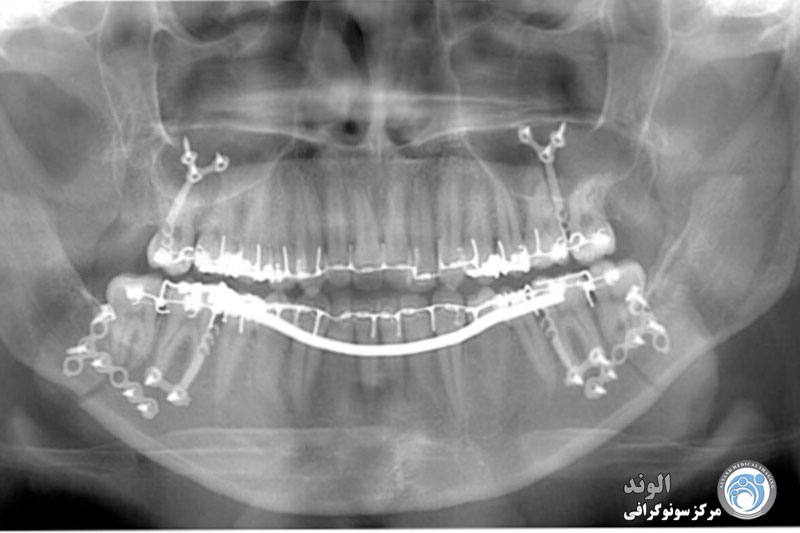 s/عکس opg عکس opg