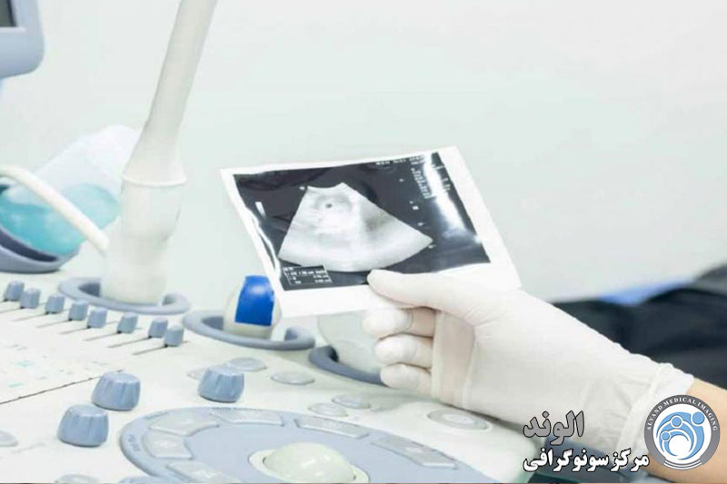 s/سونوگرافی چیست؟ سونوگرافی چیست؟