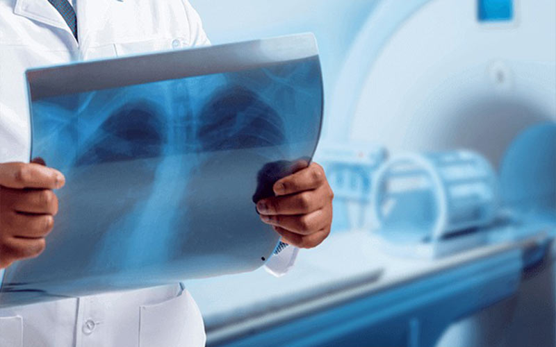 ام آر آی چیست؟ j/ام آر آی چیست؟