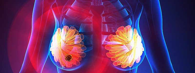 ماموگرافی چیست؟ f/ماموگرافی چیست؟