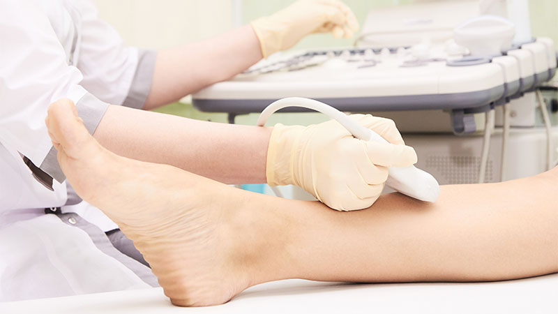 سونوگرافی داپلر عروق d/سونوگرافی داپلر عروق