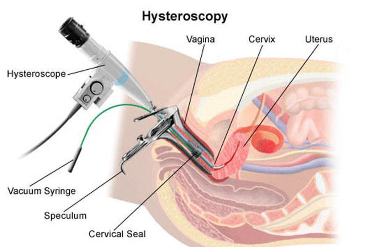 عکس رنگی رحم چیست؟ r/عکس رنگی رحم چیست؟