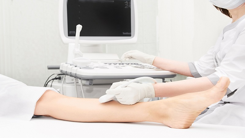 سونوگرافی داپلر عروق d/سونوگرافی داپلر عروق