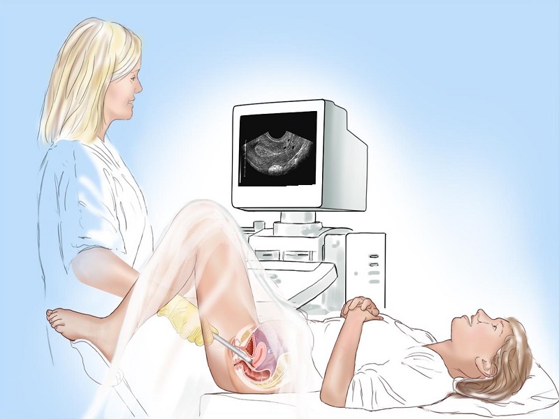 سونوگرافی واژینال در تهران h/سونوگرافی واژینال در تهران