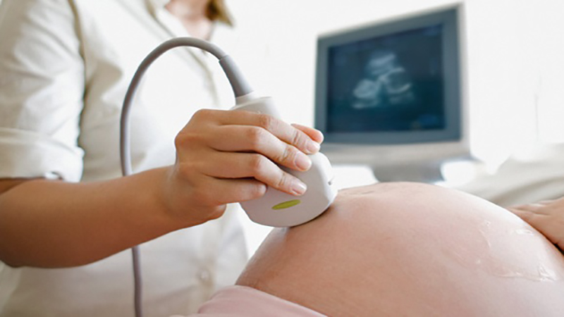 انواع سونوگرافی a/انواع سونوگرافی