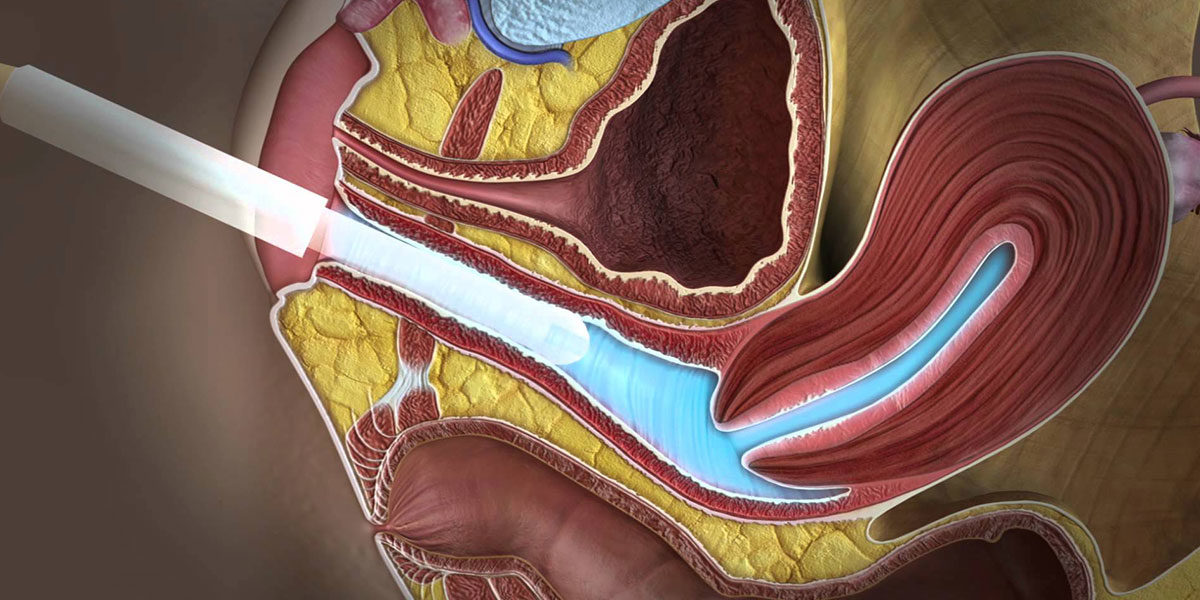 سونوگرافی سه بعدی واژینال d/سونوگرافی سه بعدی واژینال