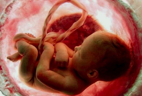 اکوکاردیوگرافی جنین e/اکوکاردیوگرافی جنین