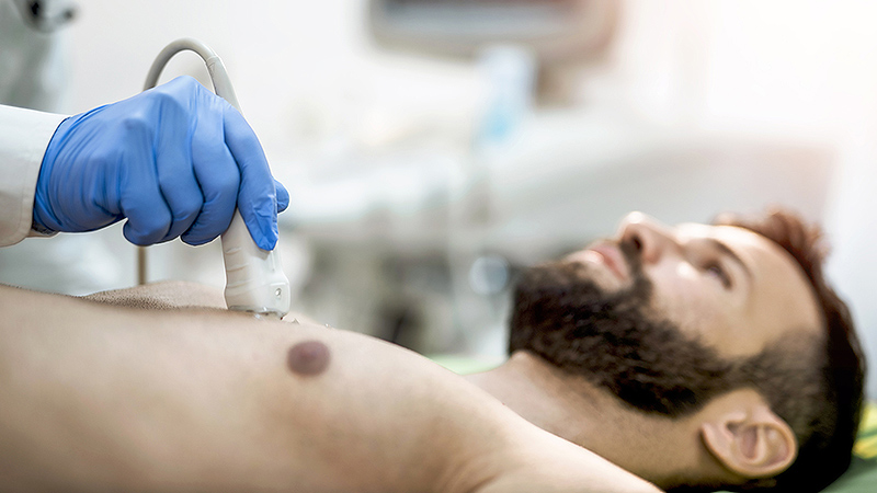 سونوگرافی سینه و زیر بغل A/سونوگرافی سینه و زیر بغل