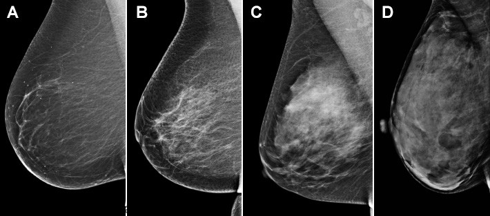 مرکز سونوگرافی سینه u/مرکز سونوگرافی سینه
