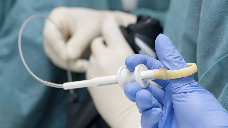 بیوپسی X/بیوپسی