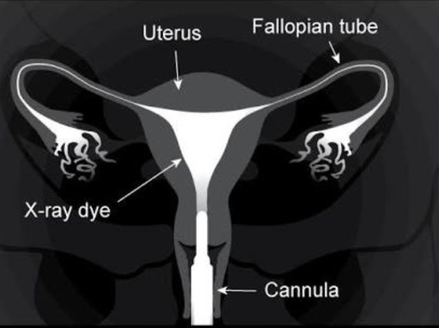 عکس رنگی رحم بدون درد H/عکس رنگی رحم