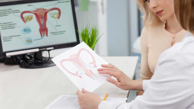 عکس رنگی رحم با بی حسی در تهران Hysterosalpingogram/عکس رنگی رحم با بی حسی در تهران