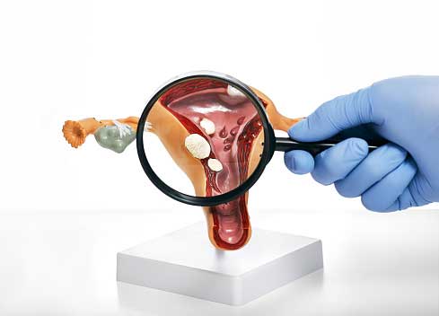 عکس رنگی رحم چیست؟ What is a color photo of the uterus?/عکس رنگی رحم چیست؟