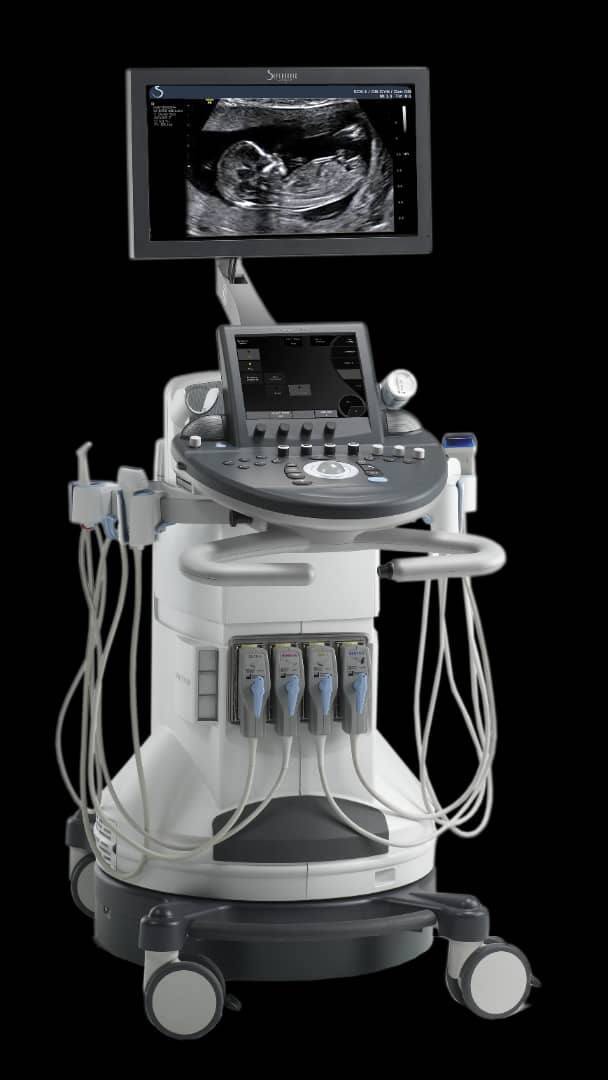 سونوگرافی انومالی اسکن D/سونوگرافی انومالی اسکن